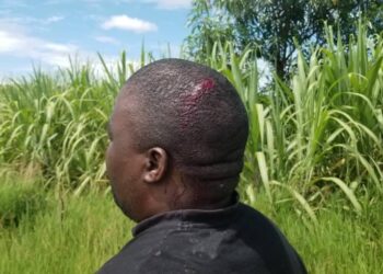 DPP supporters attacked in Lilongwe